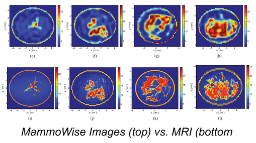 MammoWise-top vs MRI-bottom